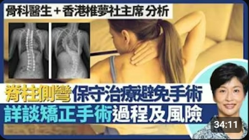 Understanding Scoliosis (II): Treating Scoliosis - Conservative Care versus Surgery?